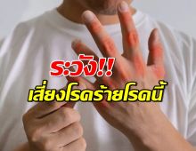 ระวัง!!!ปล่อยให้ ร่างกายมีกรดยูริกมากไป เสี่ยงโรคร้ายโรคนี้