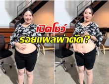 โฟกัส จีระกุล เฉลย ที่ผอมลงเร็วเพราะผ่าตัดกระเพาะ?