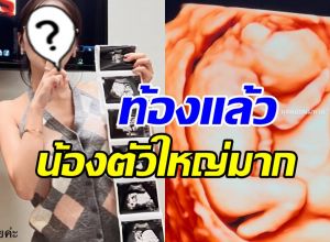 กรี๊ด! ดาราสาวดัง อวดภาพอัลตร้าซาวด์เบบี๋ ท้อง3เดือนแล้ว