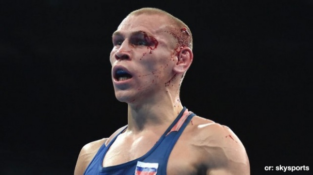    นักมวยรัสเซียที่ชนะฉัตรชัย ขอถอนตัว โอลิมปิค หลังถูกต่อยเจ็บหนัก!