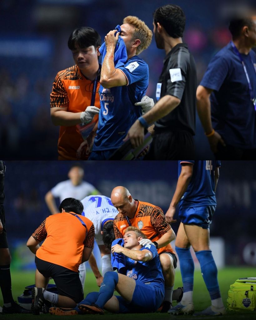 ด่วน! เผยภาพ ธีราทร หลังปะทะเดือดเลือดอาบ เมียแจ้งข่าวล่าสุด