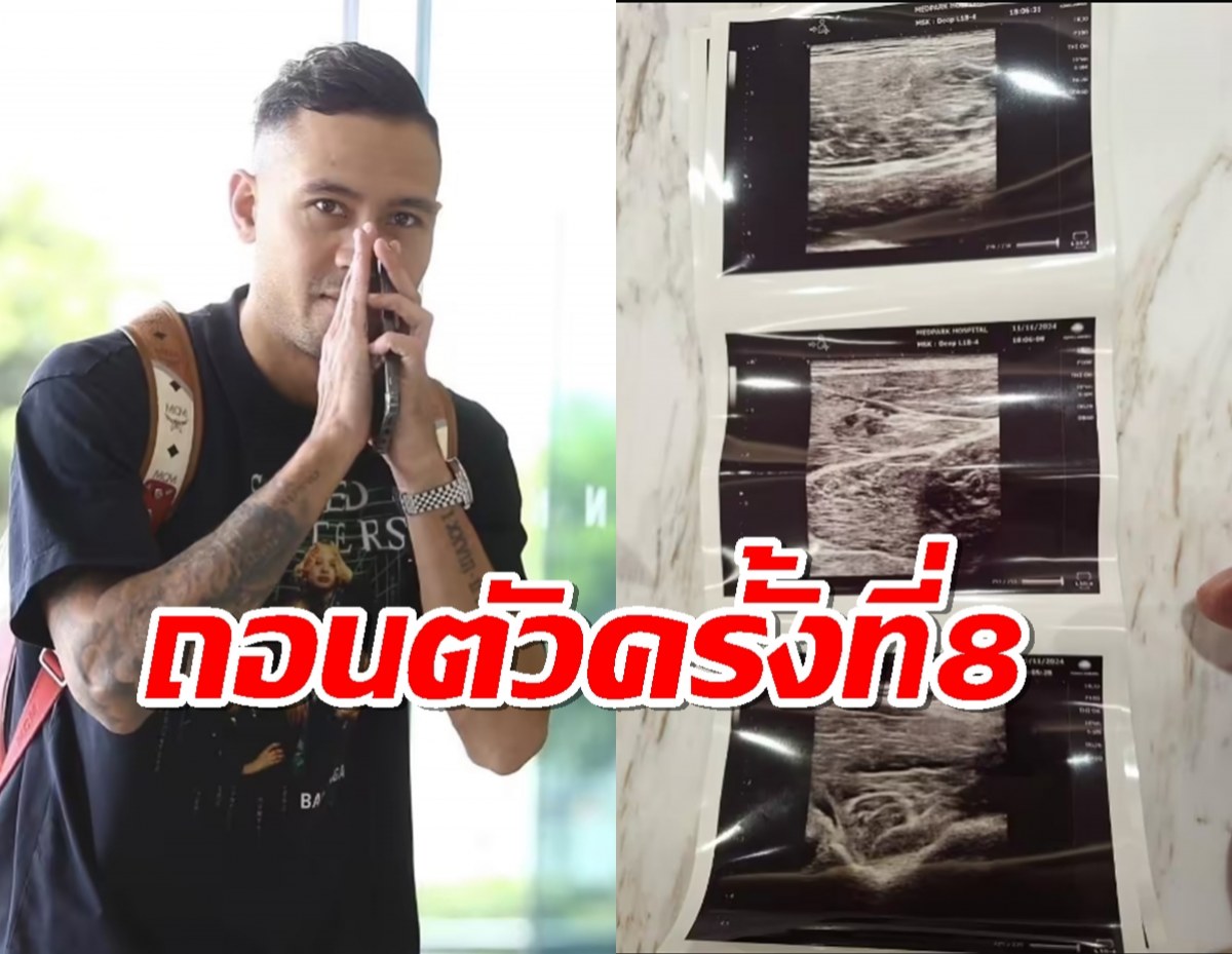 รอบที่8 "เควินดีรมรัมย์" ถอนตัวทีมชาติไทย หลังพบมีอาการบาดเจ็บ