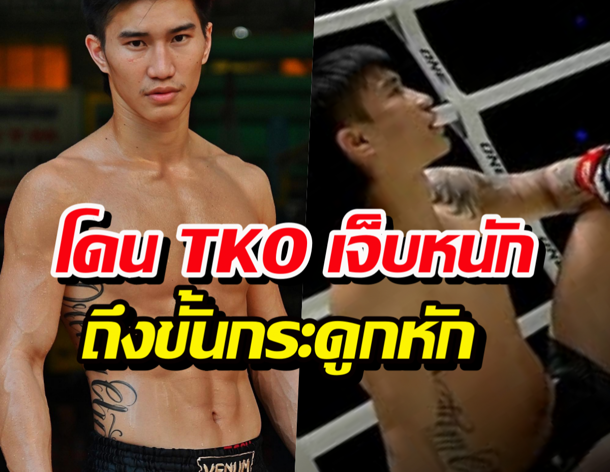 ไม่ใช่แค่แพ้! เผยอาการ 'ตะวันฉาย' หลังโดน TKO เจ็บหนักถึงขั้นกระดูกหัก