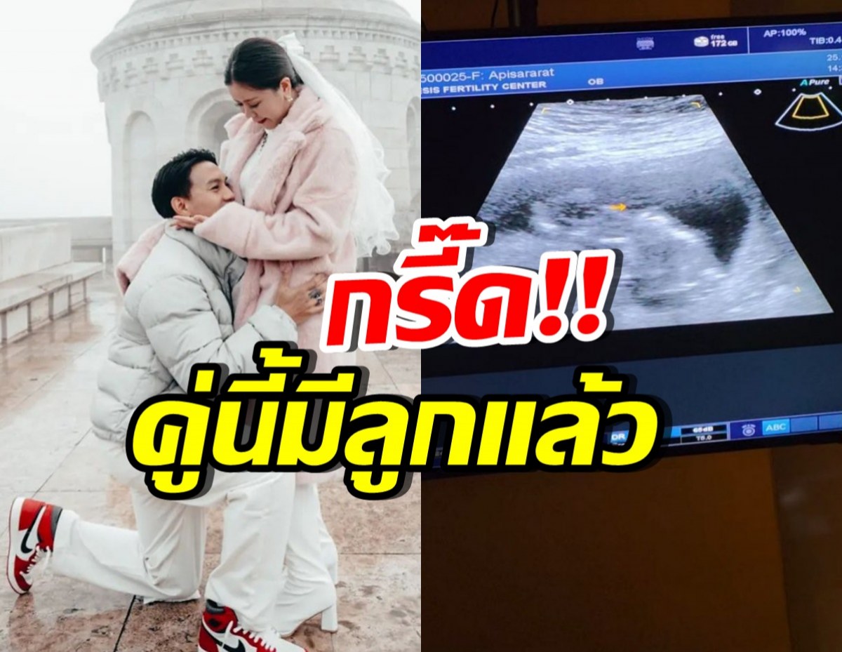 สิ้นสุดการรอคอย! คู่รักคู่นี้ มีลูกคนแรกสำเร็จแล้ว