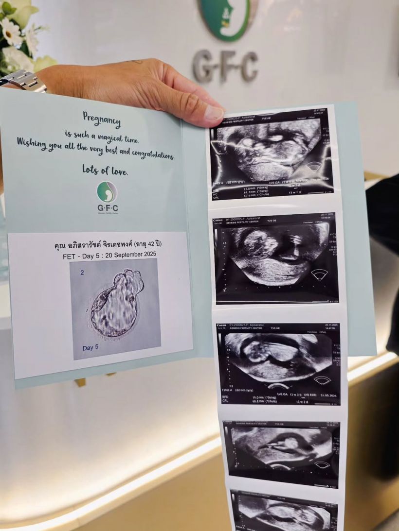 สิ้นสุดการรอคอย! คู่รักคู่นี้ มีลูกคนแรกสำเร็จแล้ว