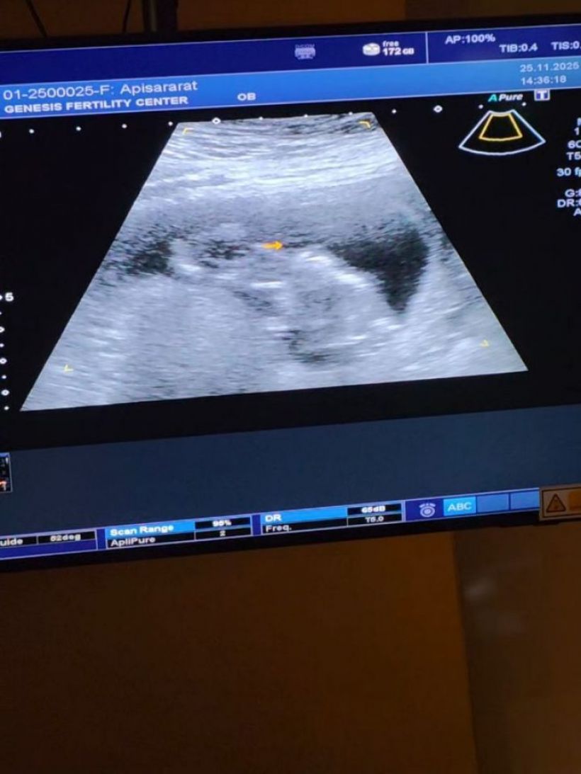 สิ้นสุดการรอคอย! คู่รักคู่นี้ มีลูกคนแรกสำเร็จแล้ว